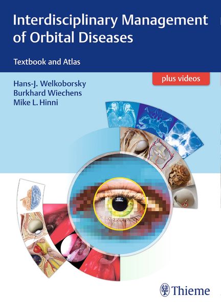 Produktbild: Interdisciplinary Management of Orbital Diseases