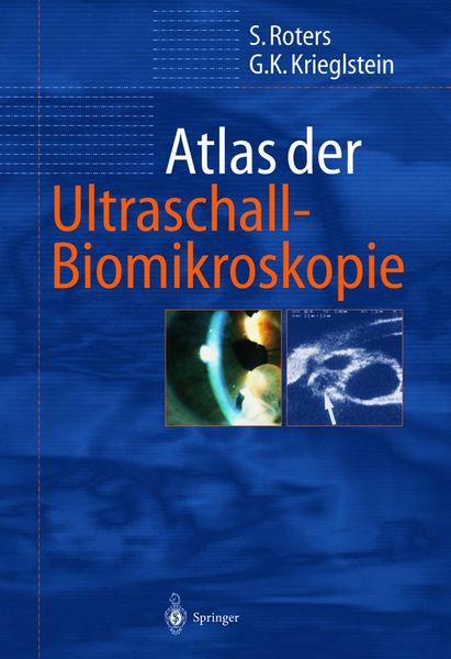 Produktbild: Atlas der Ultraschall-Biomikroskopie