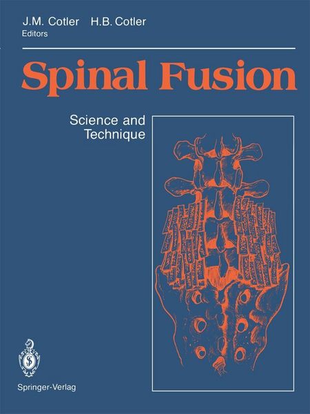 Produktbild: Spinal Fusion