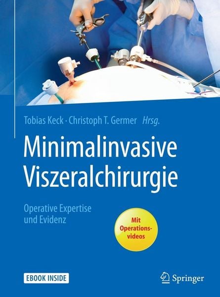 Produktbild: Minimalinvasive Viszeralchirurgie