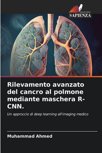 Produktbild: Rilevamento avanzato del cancro al polmone mediante maschera R-CNN.