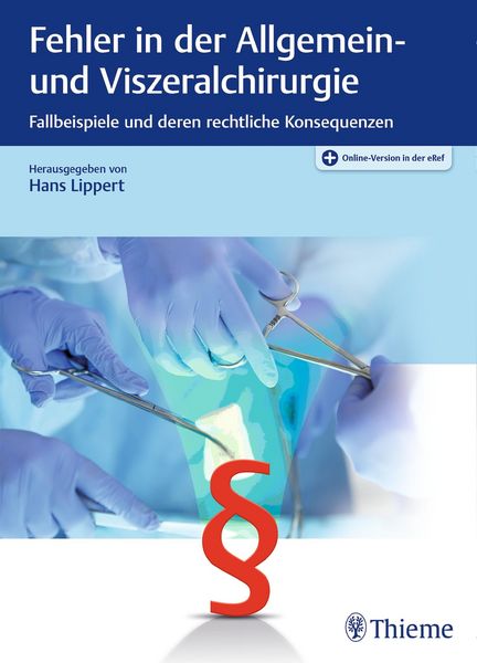 Produktbild: Fehler in der Allgemein- und Viszeralchirurgie
