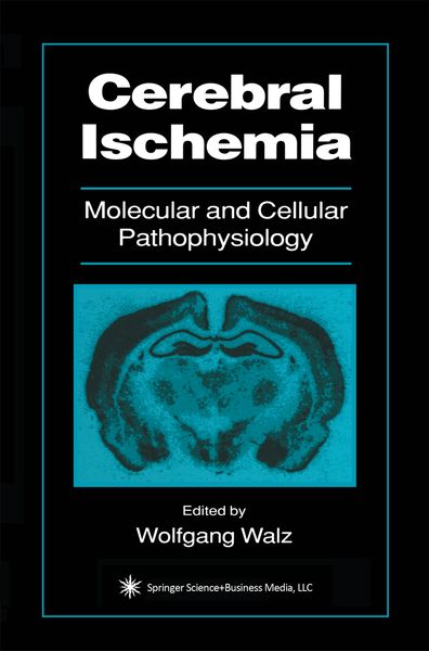 Produktbild: Cerebral Ischemia