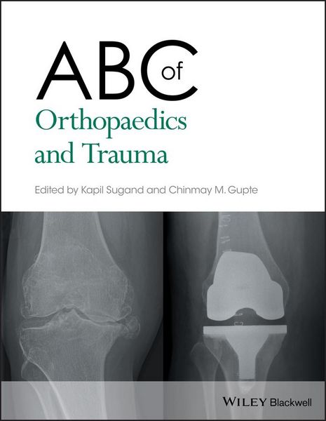 Produktbild: ABC of Orthopaedics and Trauma