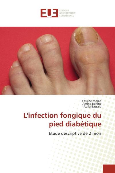 Produktbild: L'infection fongique du pied diab&eacute;tique