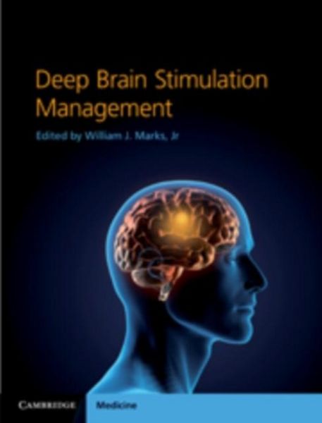 Produktbild: Deep Brain Stimulation Management