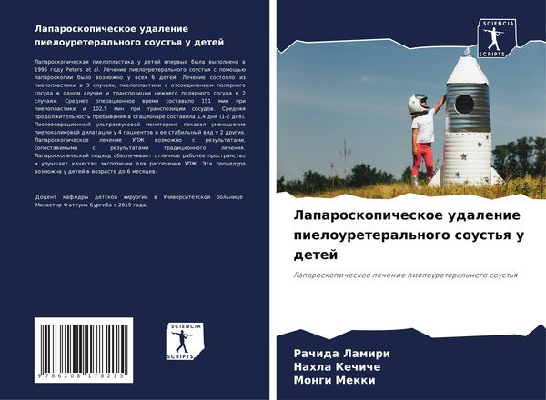 Produktbild: Laparoskopicheskoe udalenie pieloureteral'nogo soust'q u detej