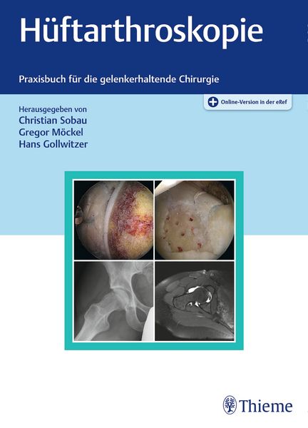 Produktbild: H&uuml;ftarthroskopie