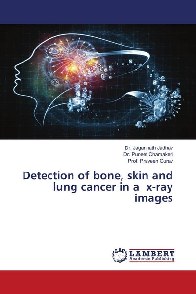 Produktbild: Detection of bone, skin and lung cancer in a x-ray images