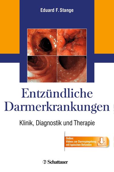 Produktbild: Entz&uuml;ndliche Darmerkrankungen