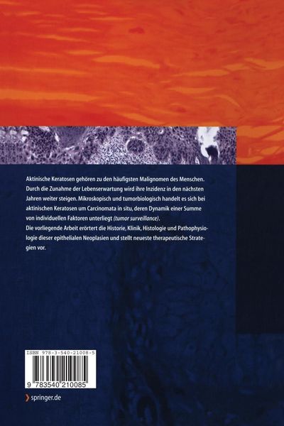 Produktbild: Aktinische Keratosen (Carcinomata in situ)