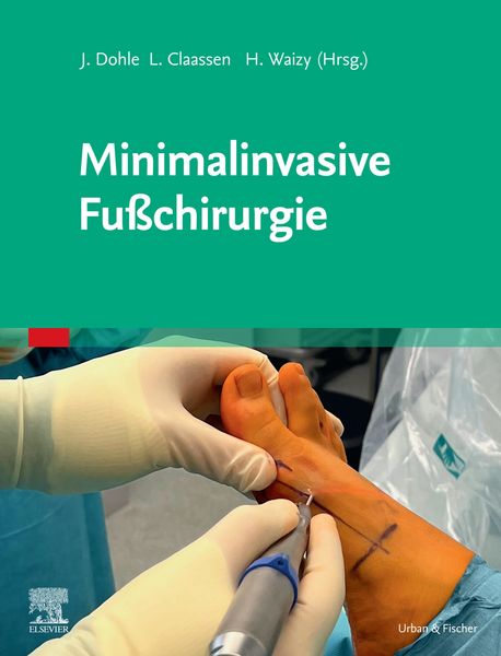 Produktbild: Minimalinvasive Fu&szlig;chirurgie