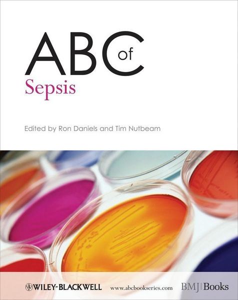 Produktbild: ABC of Sepsis
