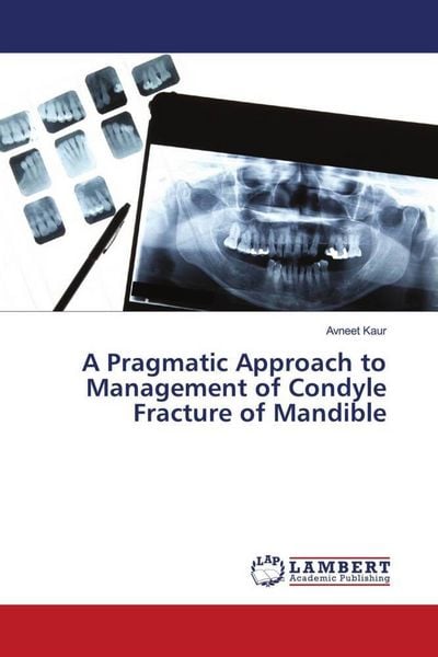 Produktbild: A Pragmatic Approach to Management of Condyle Fracture of Mandible