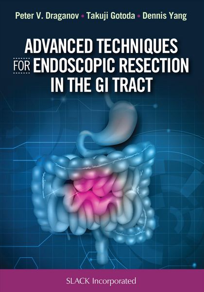 Produktbild: Advanced Techniques for Endoscopic Resection in the GI Tract