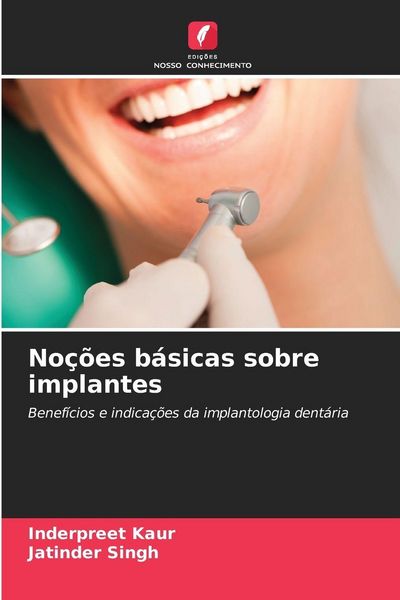 Produktbild: No&ccedil;&otilde;es b&aacute;sicas sobre implantes