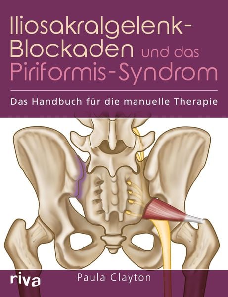 Produktbild: Iliosakralgelenk-Blockaden und das Piriformis-Syndrom