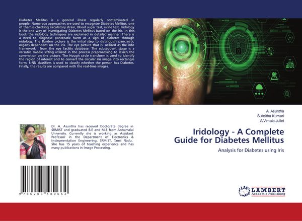 Produktbild: Iridology - A Complete Guide for Diabetes Mellitus