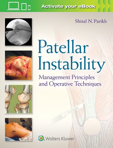 Produktbild: Patellar Instability