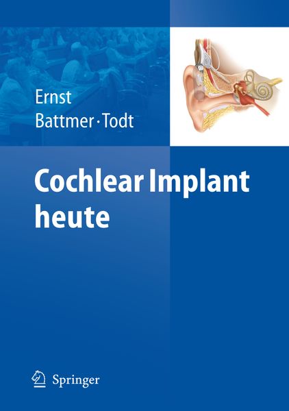 Produktbild: Cochlear Implant heute
