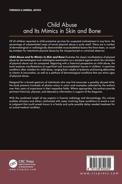 Produktbild: Child Abuse and its Mimics in Skin and Bone
