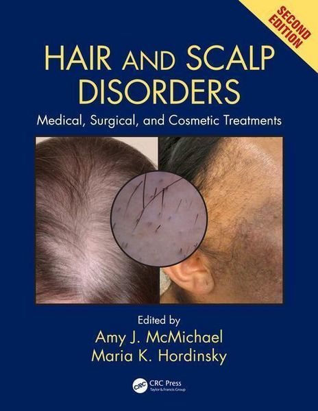 Produktbild: Hair and Scalp Disorders
