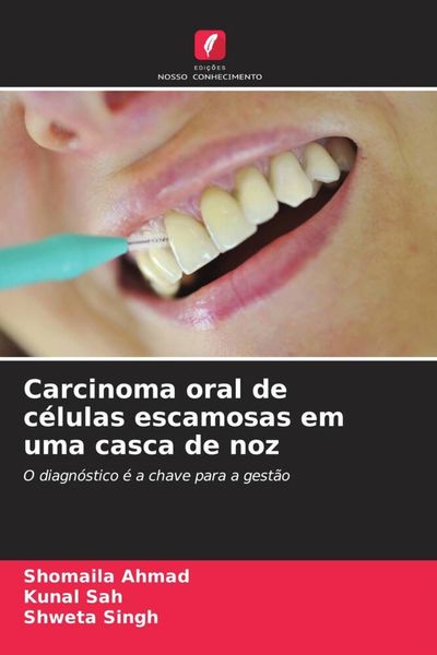 Produktbild: Carcinoma oral de c&eacute;lulas escamosas em uma casca de noz