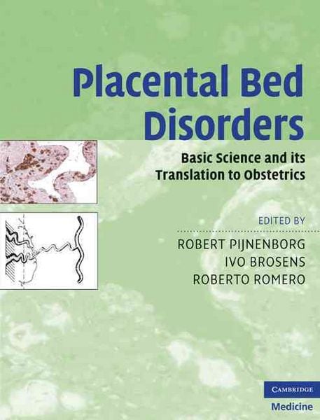 Produktbild: Placental Bed Disorders