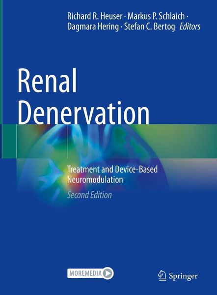Produktbild: Renal Denervation