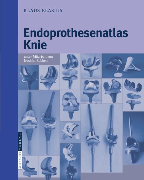 Endoprothesenatlas Knie, Taschenbuch von Klaus Bläsius, Steinkopff, 9783798517660