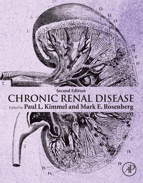 Produktbild: Chronic Renal Disease