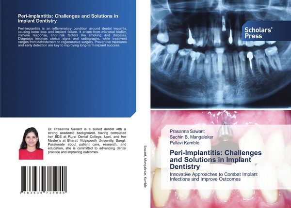 Produktbild: Peri-Implantitis: Challenges and Solutions in Implant Dentistry