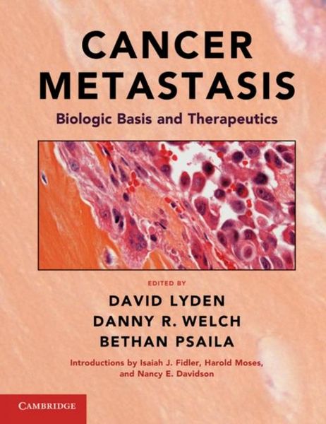 Produktbild: Cancer Metastasis