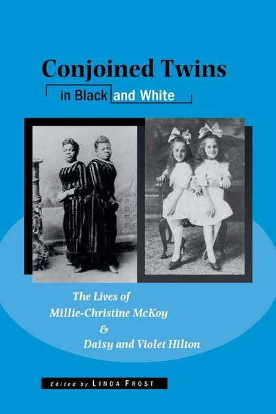 Produktbild: Conjoined Twins in Black and White