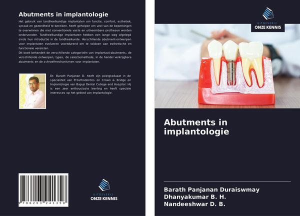 Produktbild: Abutments in implantologie
