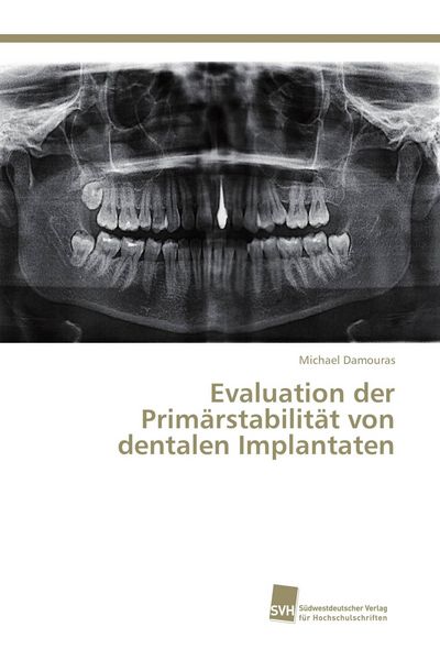 Produktbild: Evaluation der Prim&auml;rstabilit&auml;t von dentalen Implantaten