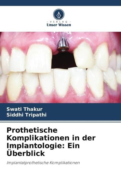 Produktbild: Prothetische Komplikationen in der Implantologie: Ein &Uuml;berblick