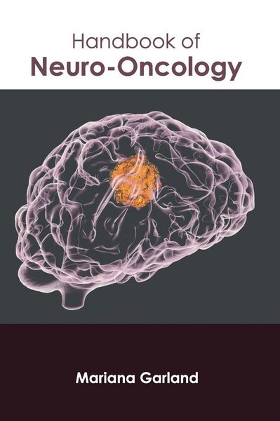 Produktbild: Handbook of Neuro-Oncology