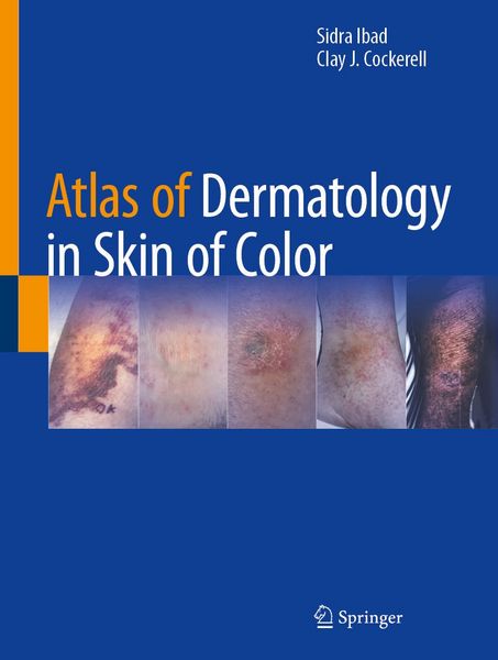 Produktbild: Atlas of Dermatology in Skin of Color