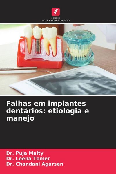 Produktbild: Falhas em implantes dent&aacute;rios: etiologia e manejo