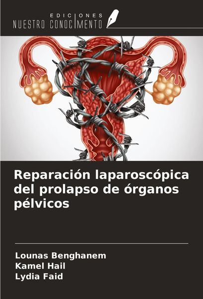 Produktbild: Reparaci&oacute;n laparosc&oacute;pica del prolapso de &oacute;rganos p&eacute;lvicos