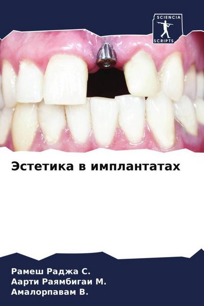 Produktbild: Jestetika w implantatah