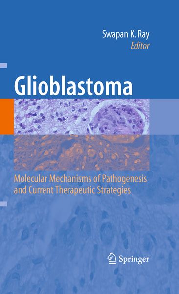 Produktbild: Glioblastoma: