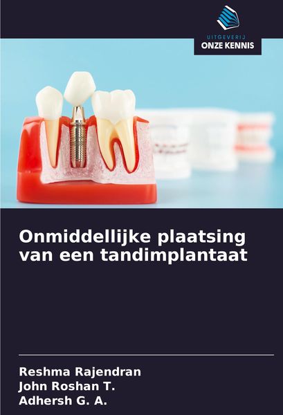 Produktbild: Onmiddellijke plaatsing van een tandimplantaat