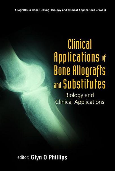 Produktbild: Clinical Applications of Bone Allografts and Substitutes: Biology and Clinical Applications