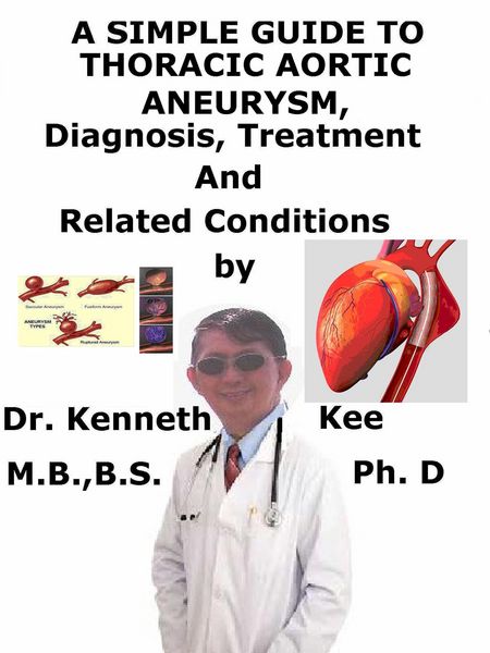 Produktbild: A Simple Guide to Thoracic Aortic Aneurysm, Diagnosis, Treatment and Related Conditions