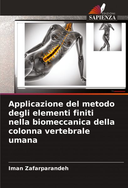 Produktbild: Applicazione del metodo degli elementi finiti nella biomeccanica della colonna vertebrale umana