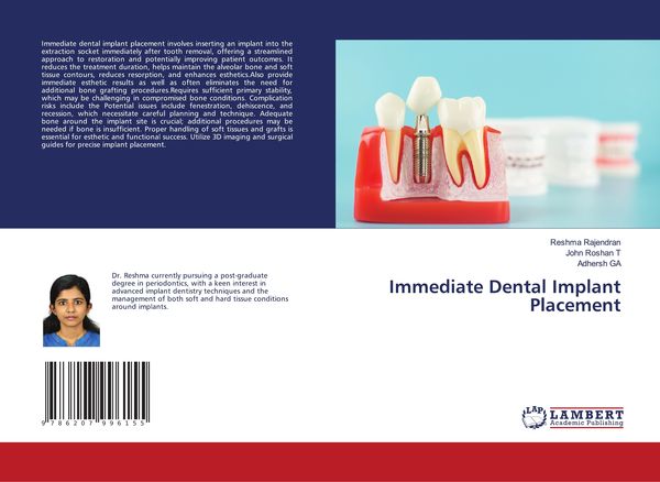 Produktbild: Immediate Dental Implant Placement