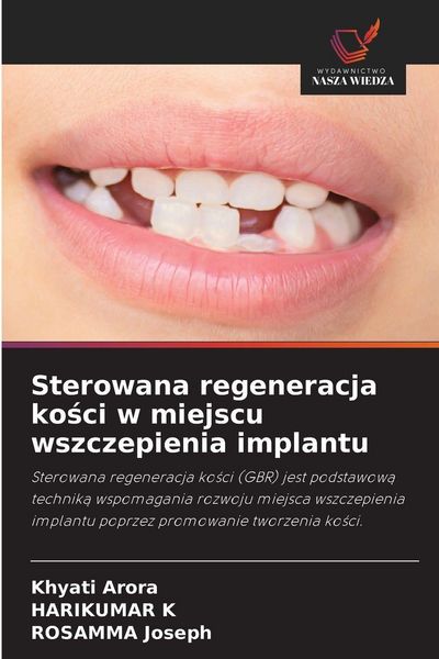 Produktbild: Sterowana regeneracja ko&iquest;ci w miejscu wszczepienia implantu