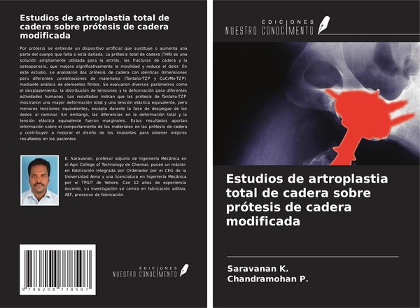 Produktbild: Estudios de artroplastia total de cadera sobre pr&oacute;tesis de cadera modificada